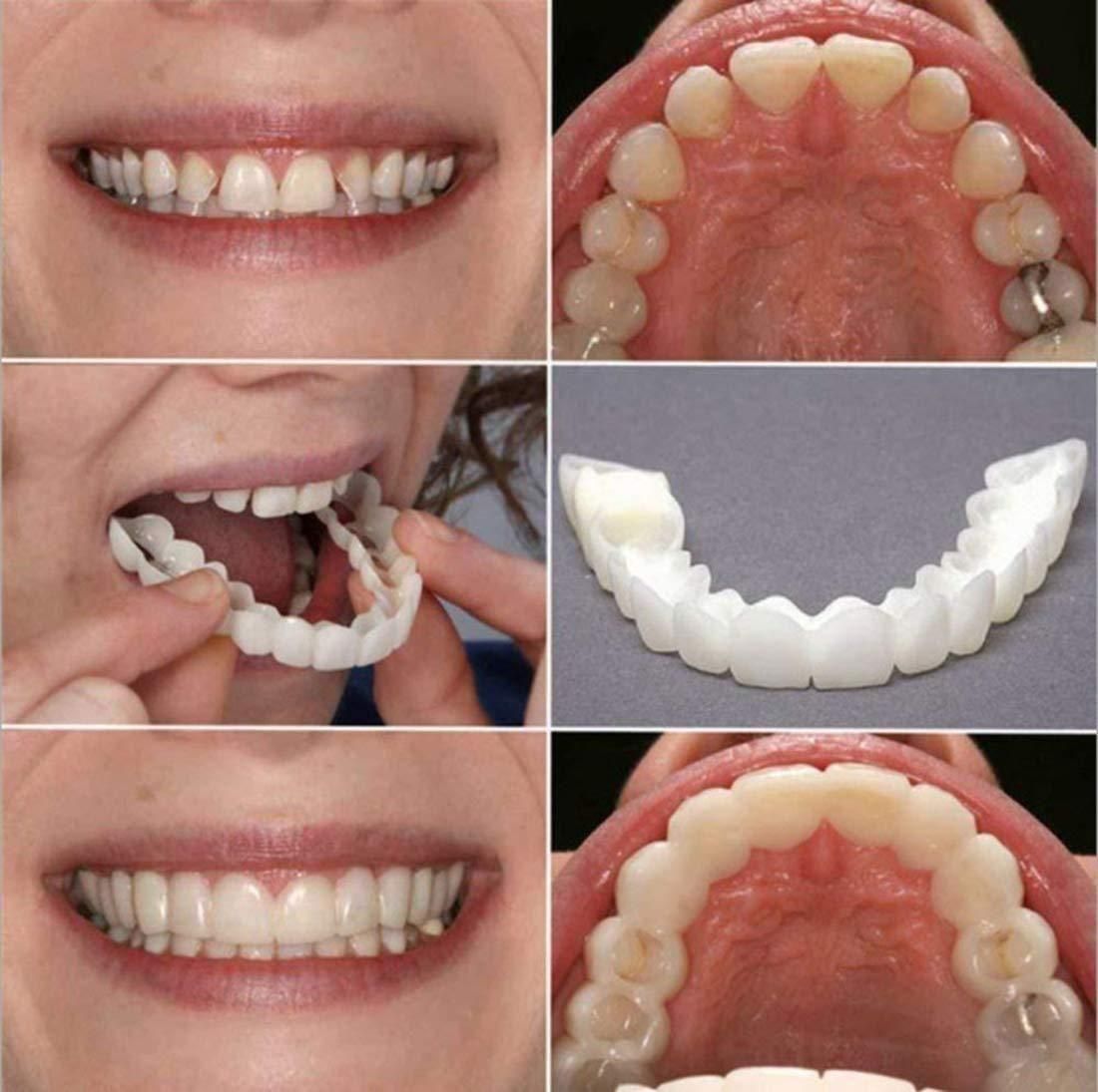 Instant perfect Smile Comfort Fit Flex Teeth Veneers