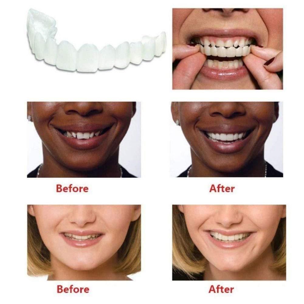 Instant perfect Smile Comfort Fit Flex Teeth Veneers
